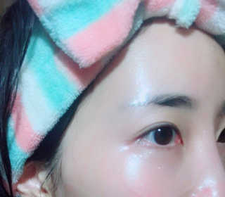 [더마허브] 주사팩 5종, 물광,백옥,태반,신데렐라 등 — 5점을 준 리뷰어가 2018년 2월 올린 사용 사진