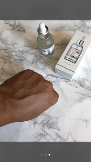 [마녀 공장] 발가락 토미 니아신 에센스 50ml — 5점을 준 리뷰어가 2018년 10월 올린 사용 사진