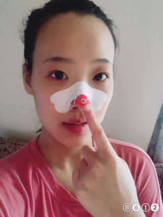 나이팅게일 TAKO PACK NOSE [문어코팩] — 4점을 준 리뷰어가 2017년 4월 올린 사용 사진