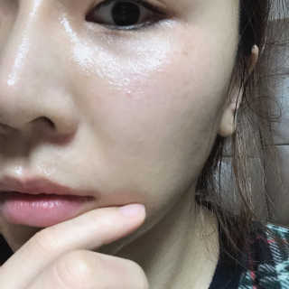 로벡틴 닥터 마스크 시카 — 4.5점을 준 리뷰어가 2019년 12월 올린 사용 사진