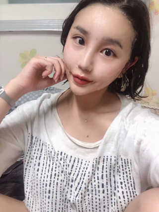 메디타임 멜라반 더마 토닝 씬젤 — 4점을 준 리뷰어가 2019년 6월 올린 사용 사진