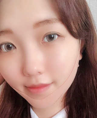 아이디플라코스메틱 아이디 페이스핏 마이너스 밴드 — 5점을 준 리뷰어가 2019년 9월 올린 사용 사진