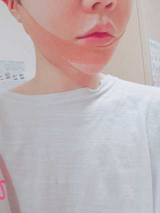 아이디플라코스메틱 아이디 페이스핏 마이너스 밴드 — 5점을 준 리뷰어가 2020년 3월 올린 사용 사진