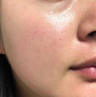 보나쥬르 가지 데일리 BHA 토너 — 5점을 준 리뷰어가 2018년 3월 올린 사용 사진