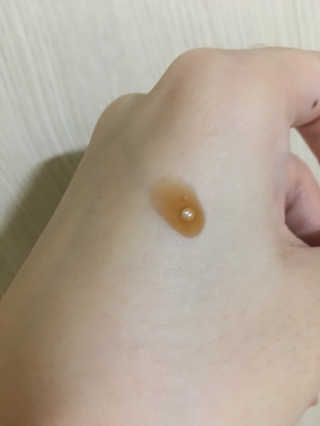 제너럴라이프 프로폴리스 마누카허니 액티브 세럼 — 5점을 준 리뷰어가 2018년 11월 올린 사용 사진