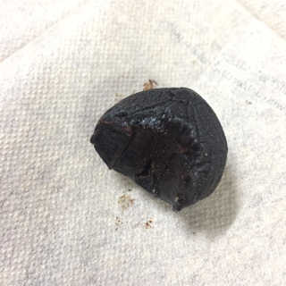 정신무역 티베트 히말라야 샹그릴라 통흑마늘 250g — 5점을 준 리뷰어가 2020년 3월 올린 사용 사진