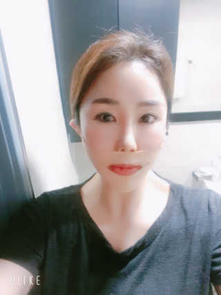 아이디플라코스메틱 아이디 페이스핏 마이너스 밴드 — 4.5점을 준 리뷰어가 2019년 9월 올린 사용 사진