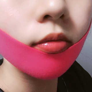 스케덤 펩타이드 리프팅밴드 — 5점을 준 리뷰어가 2019년 3월 올린 사용 사진