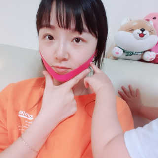 스케덤 펩타이드 리프팅밴드 — 4점을 준 리뷰어가 2019년 5월 올린 사용 사진