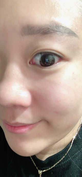 눈누난나 아이 릴리프 메이크업 리무버 + 클렌징 패드 — 4.5점을 준 리뷰어가 2019년 11월 올린 사용 사진