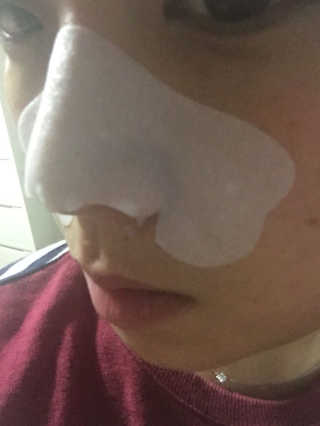 나이팅게일 TAKO PACK NOSE [문어코팩] — 3.5점을 준 리뷰어가 2017년 3월 올린 사용 사진