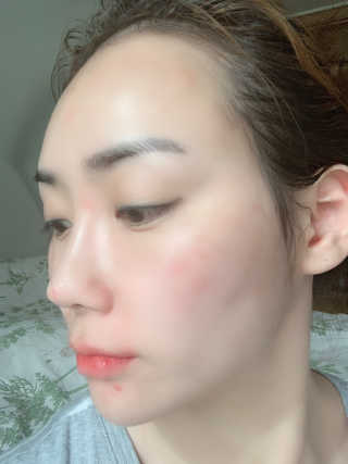이지함 메디컬러 핑크원 블루원 그린원 — 4점을 준 리뷰어가 2019년 6월 올린 사용 사진