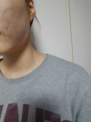 23years old 블랙페인트럽바 — 3.33점을 준 리뷰어가 2018년 3월 올린 사용 사진