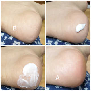 (주)에네스티 에네스티 수안수 실크스킨 풋크림 1+1 — 3점을 준 리뷰어가 2019년 10월 올린 사용 사진