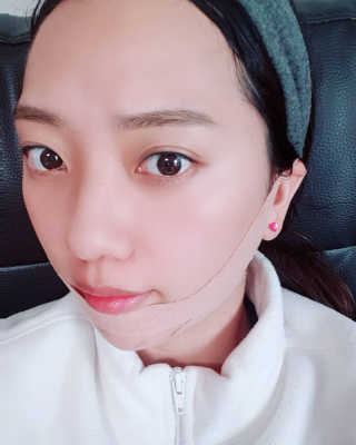 아이디플라코스메틱 아이디 페이스핏 마이너스 밴드 — 5점을 준 리뷰어가 2019년 12월 올린 사용 사진