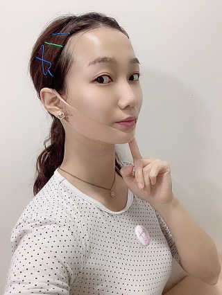 아이디플라코스메틱 아이디 페이스핏 마이너스 밴드 — 5점을 준 리뷰어가 2019년 10월 올린 사용 사진