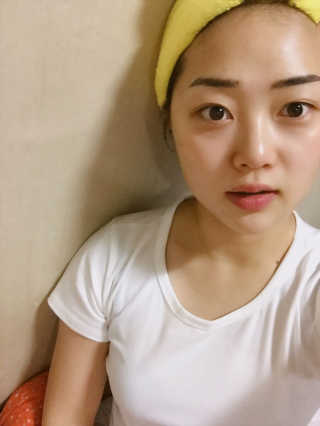 누미스메드 우레아 히알루론 나이트크림 — 4.33점을 준 리뷰어가 2017년 12월 올린 사용 사진