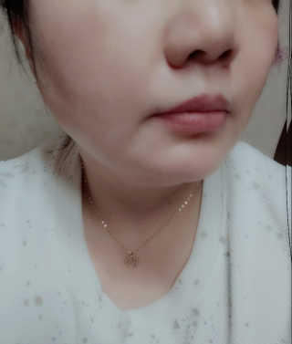 charming_skin님이 올린 리뷰 사진 3