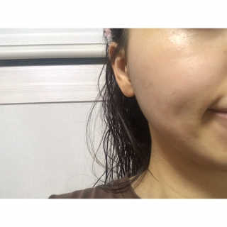 셀퓨전씨 카밍 다운 크림 — 4.17점을 준 리뷰어가 2018년 11월 올린 사용 사진