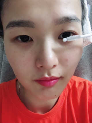 에이페 아이래쉬 리치 세럼 — 4.33점을 준 리뷰어가 2018년 9월 올린 사용 사진