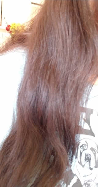 아이로로 디어 스칼프 인핸 시브 안티 헤어 로스 트리트먼트 — 5점을 준 리뷰어가 2019년 10월 올린 사용 사진