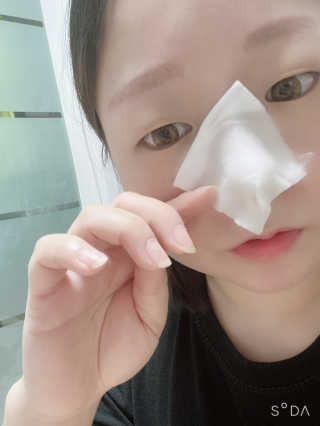 [메디필]엑스트라 슈퍼9 250ml+화장솜40ea — 4점을 준 리뷰어가 2020년 3월 올린 사용 사진