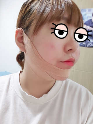 아이디플라코스메틱 아이디 페이스핏 마이너스 밴드 — 5점을 준 리뷰어가 2019년 9월 올린 사용 사진
