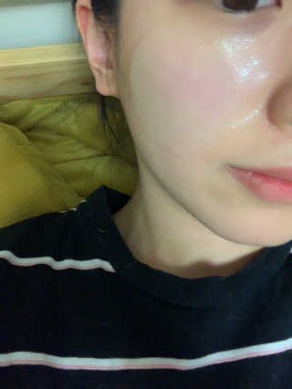 자이엘 S.O.S 레드 칙 케어팩 2 Box — 5점을 준 리뷰어가 2020년 2월 올린 사용 사진