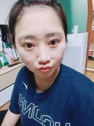 셀퓨전씨 트리악 포어 딜리트 버블 팩 — 3.33점을 준 리뷰어가 2018년 4월 올린 사용 사진
