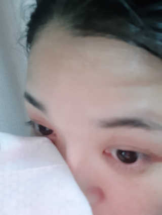 블루캐롯 닦는 루테인, 아이케어 티슈 20P — 3점을 준 리뷰어가 2019년 11월 올린 사용 사진