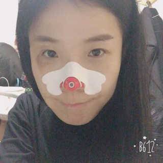 나이팅게일 TAKO PACK NOSE [문어코팩] — 5점을 준 리뷰어가 2017년 5월 올린 사용 사진