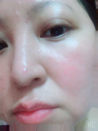[스킨큐어] 산다화 비타민C 화이트닝 에센스 30ml — 4.5점을 준 리뷰어가 2019년 7월 올린 사용 사진