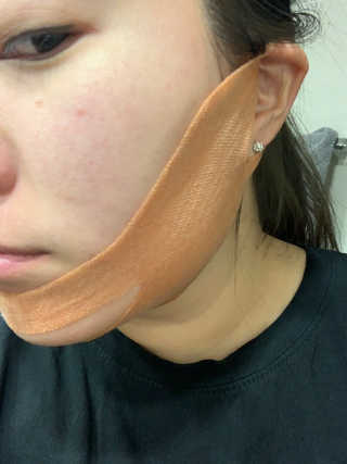 아이디플라코스메틱 아이디 페이스핏 마이너스 밴드 — 4점을 준 리뷰어가 2020년 4월 올린 사용 사진