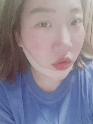 아이디플라코스메틱 아이디 페이스핏 마이너스 밴드 — 5점을 준 리뷰어가 2019년 9월 올린 사용 사진