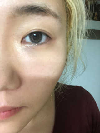 미플레이 진짜 티트리 토너 패드 — 4.33점을 준 리뷰어가 2018년 11월 올린 사용 사진