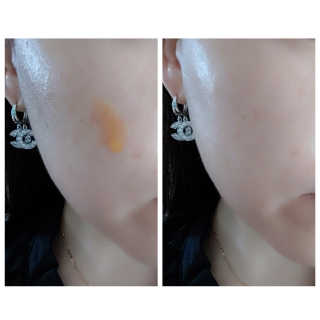메디페르 루테인 포스앰플 50ml — 5점을 준 리뷰어가 2019년 10월 올린 사용 사진