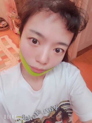 스케덤 시카 리프팅밴드 — 5점을 준 리뷰어가 2019년 5월 올린 사용 사진