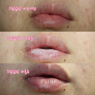 블리스텍스 립 릴리프 크림 립밤, 립 바이브런스 립밤 — 4.33점을 준 리뷰어가 2018년 11월 올린 사용 사진