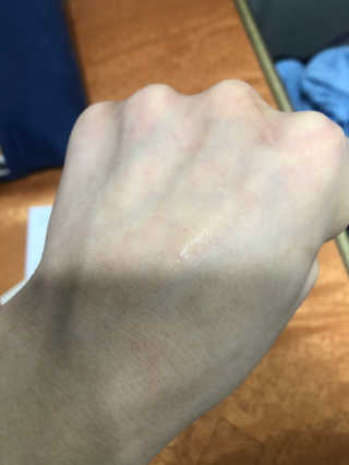 헤이톡 블루 아줄렌 카밍앰플 — 4.5점을 준 리뷰어가 2020년 1월 올린 사용 사진