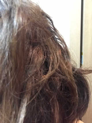 홈앤살롱 집에서 하는 모발클리닉 디스 이즈 앝 — 5점을 준 리뷰어가 2019년 8월 올린 사용 사진