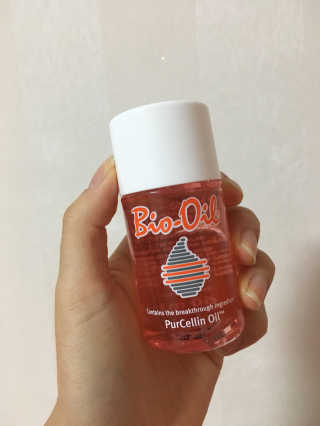 Bio-oil(바이오오일) 바이오오일(Bio-oil) — 4점을 준 리뷰어가 2017년 1월 올린 사용 사진