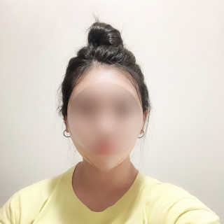 아이디플라코스메틱 아이디 페이스핏 마이너스 밴드 — 5점을 준 리뷰어가 2019년 9월 올린 사용 사진