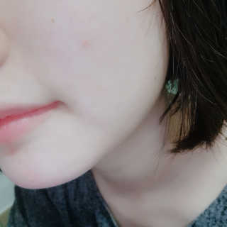 셀레뷰 슈퍼 모이스처 수딩젤 — 5점을 준 리뷰어가 2018년 4월 올린 사용 사진