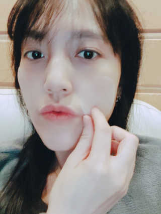 자이엘 S.O.S 레드 칙 케어팩 2 Box — 4점을 준 리뷰어가 2020년 1월 올린 사용 사진