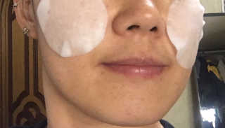 홈메디케어 티트리마스크패드 — 4.67점을 준 리뷰어가 2018년 5월 올린 사용 사진