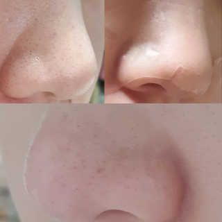 메디힐 슬리핑 멜팅 코팩 — 3점을 준 리뷰어가 2020년 1월 올린 사용 사진