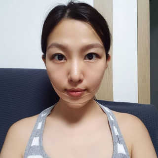 아이디플라코스메틱 아이디 페이스핏 마이너스 밴드 — 5점을 준 리뷰어가 2019년 9월 올린 사용 사진