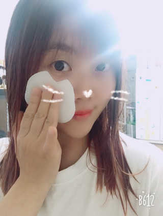 미플레이 진짜 티트리 토너 패드 — 5점을 준 리뷰어가 2018년 11월 올린 사용 사진
