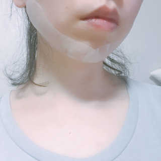리체 뷰랑셀 케어 스팟 포인트팩 — 5점을 준 리뷰어가 2017년 7월 올린 사용 사진