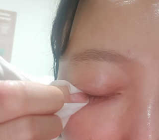 블루캐롯 닦는 루테인, 아이케어 티슈 20P — 5점을 준 리뷰어가 2019년 11월 올린 사용 사진